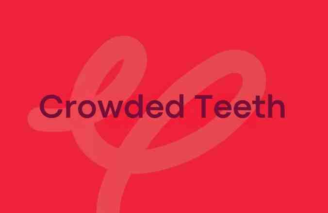 Struggling with Crowded Teeth? Here’s What You Need to Know