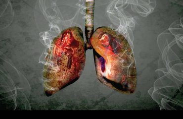 smoking-causes-lung-cancer-2.jpg